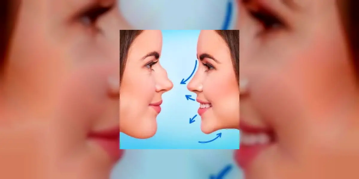 Rhinoplasty App: Nose Editor